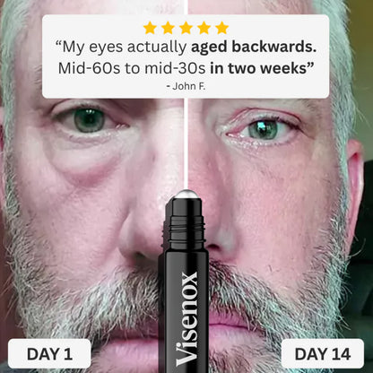 Visenox Eye Repair Stick