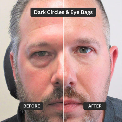 Visenox Eye Repair Stick
